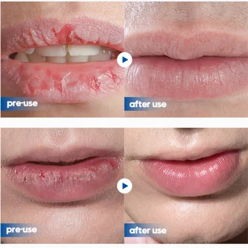 Vyrų lūpų balzamas Drėkinamasis drėkinimas Išblukusios lūpų linijos Apsauga nuo įtrūkimų Pašalinkite negyvą odą Gaivinanti ir neriebi Išskirtinė lūpų priežiūra - Nuotrauka 2  