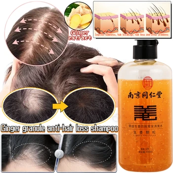 Imbiero augalų ekstraktas Šampūnas nuo plaukų slinkimo Šampūnas nuo plaukų slinkimo Plaukų augimą maitinantis plaukų folikulų taisymo šampūnas 400ml - Nuotrauka 1  
